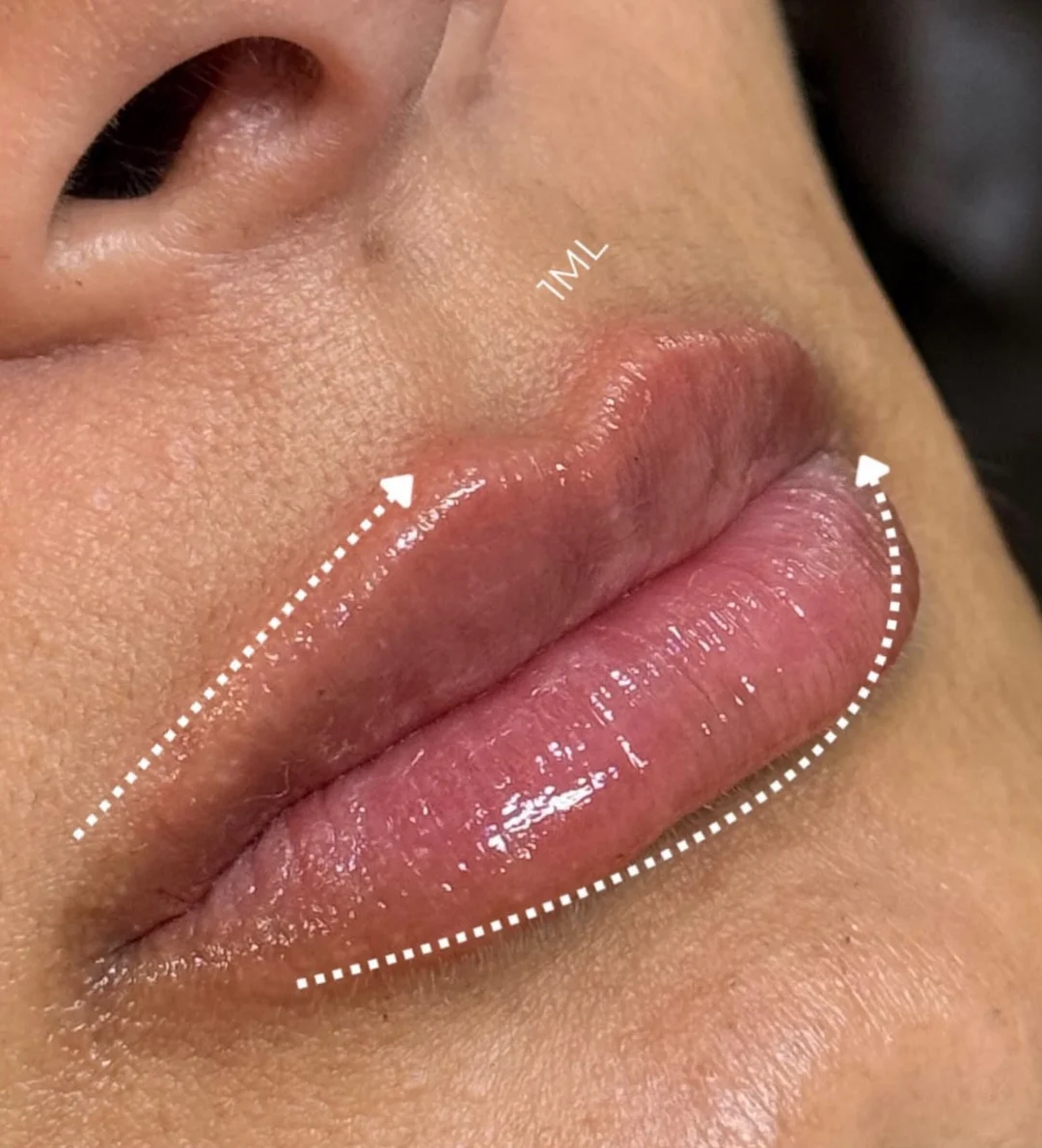 Estética Facial — resultado 1