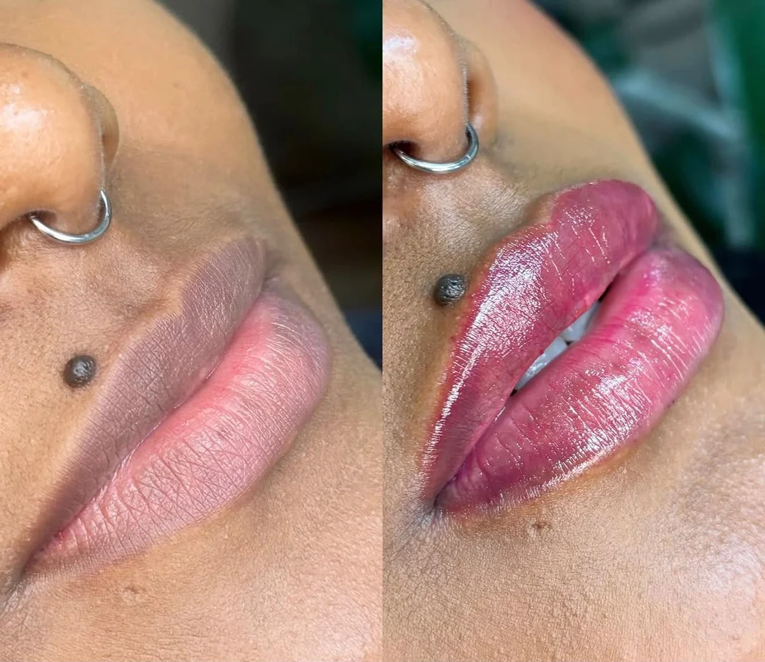 Estética Facial — resultado 2