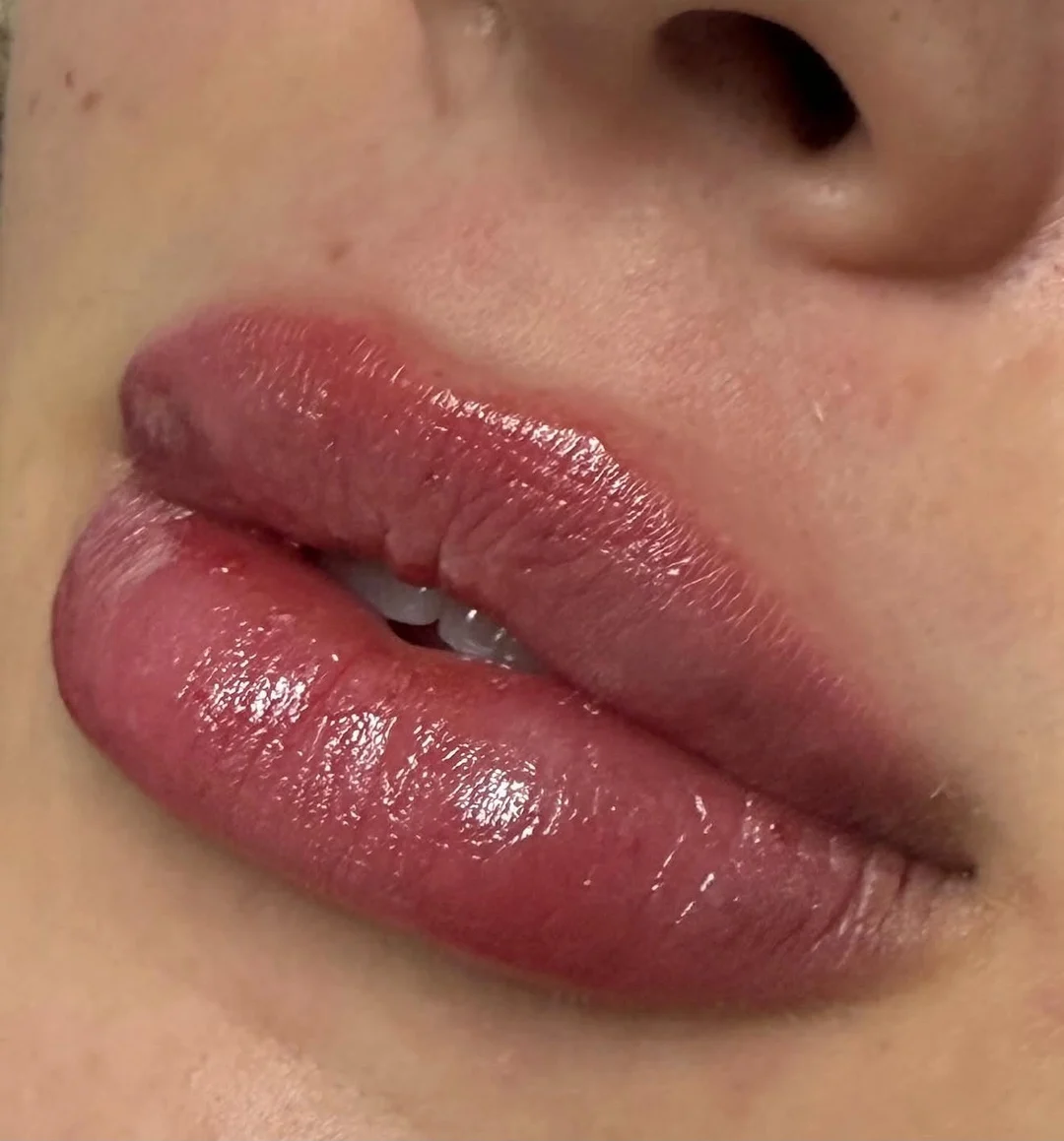Estética Facial — resultado 3
