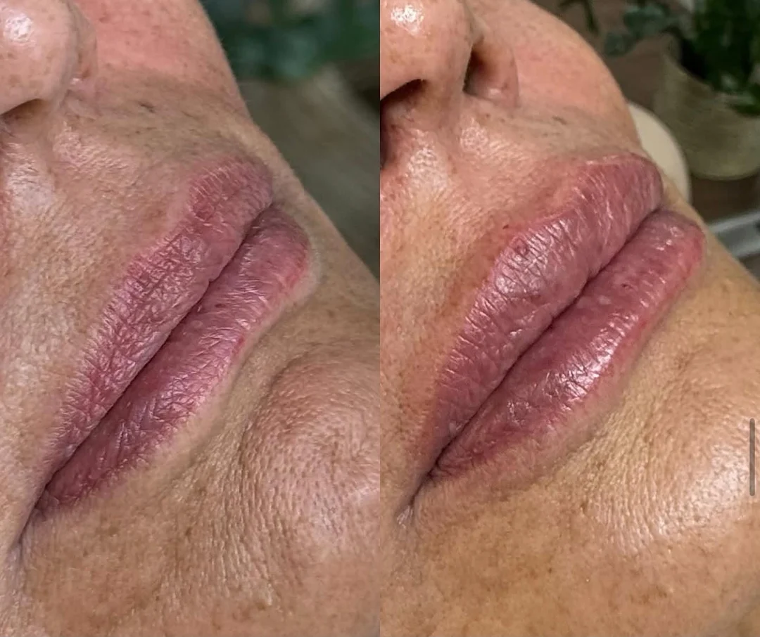 Estética Facial — resultado 4