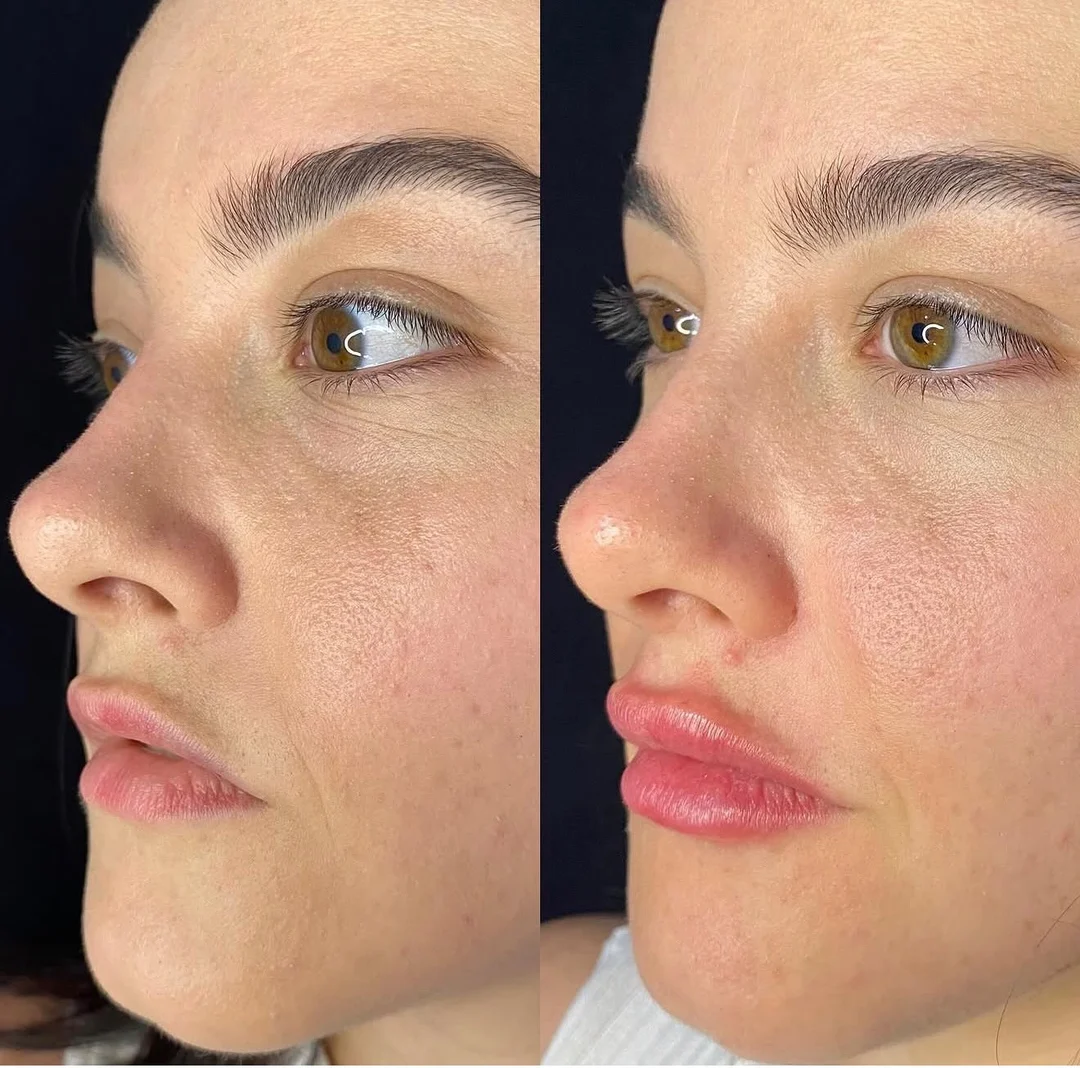 Estética Facial — resultado 5