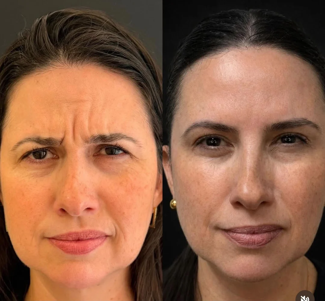 Estética Facial — resultado 7
